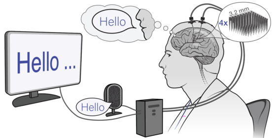 Infera Neuro ranks #1 in the Brain-to-Text '25 competition, among 466 participating teams